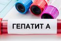 Спалах гепатиту A: чи пошириться вірус на інші регіони України?